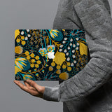 hardshell case with Autumn Leaves design combines a sleek hardshell design with vibrant colors for stylish protection against scratches, dents, and bumps for your Macbook