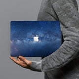 hardshell case with Starry Night design combines a sleek hardshell design with vibrant colors for stylish protection against scratches, dents, and bumps for your Macbook